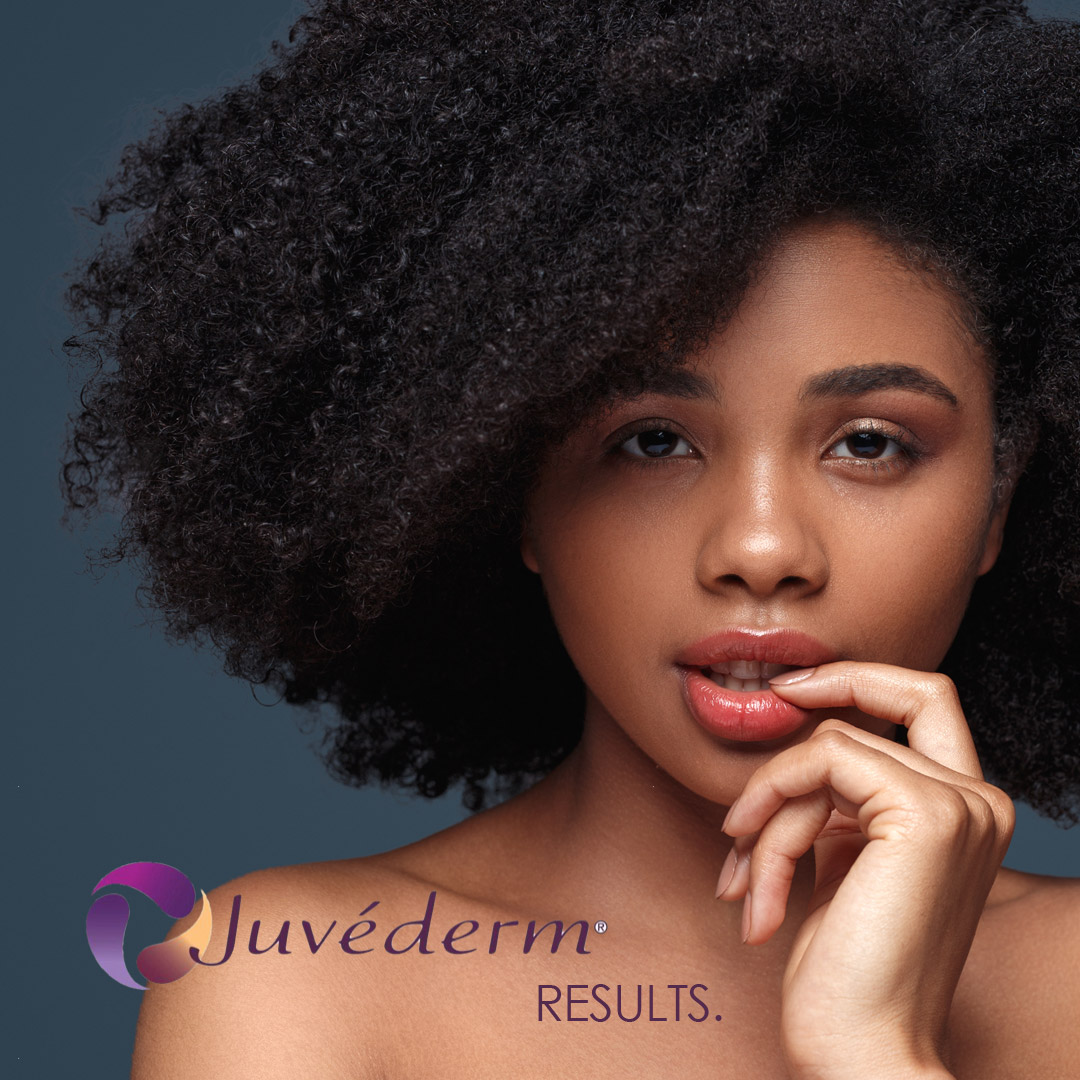 Juvederm